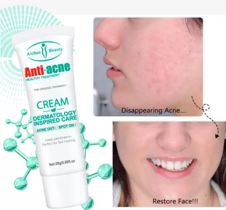 CREMA ANTI ACNE